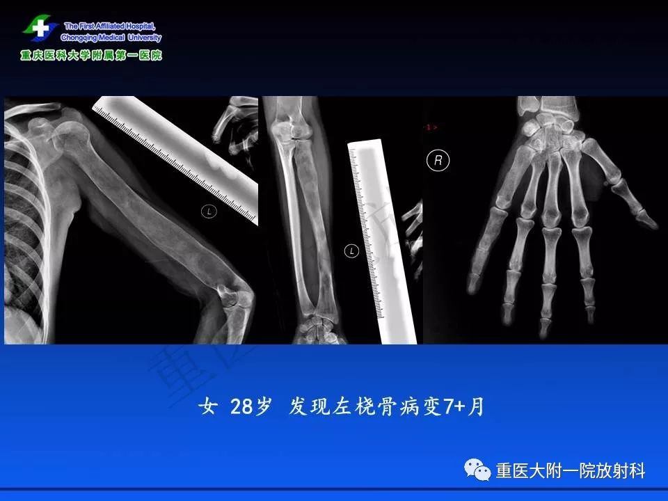 007：大戰皇家賭場