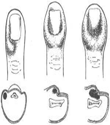 三日刺殺 视频截图